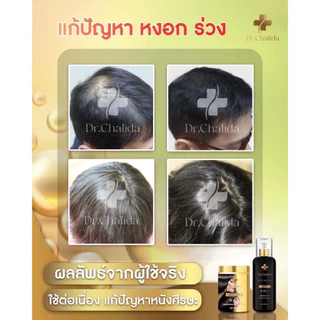 [1แถม1+ลด50%ในไลฟ์✅]Dr.Chalida ดร.ชลิดา แชมพูสมุนไพร ลดผมร่วง ลดหงอก ลดรังแค ไม่ผสมสารเคมี