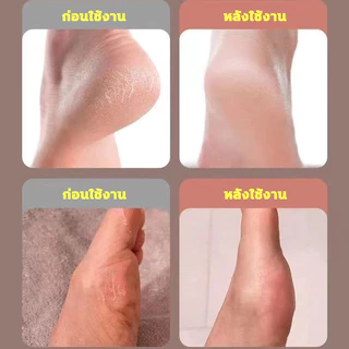 เครื่องขัดเท้า ที่ขัดส้นเท้าไฟฟ้า ที่ขัดเท้าไฟฟ้า อุปกรณ์ขัดส้นเท้า ส้นเท้าแตก Electric Callus Remover เครื่องขัดส้นเท้า