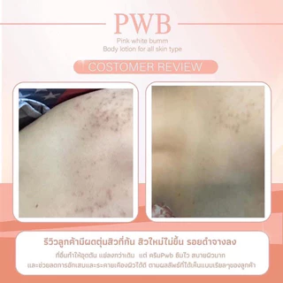 ส่งฟรี 🧡 PWB ขวดใหญ่ ของแท้💯 พร้อมของแถม ครีมก้น ลดปัญหาผิว ผิวแพ้ง่ายใช้ได้