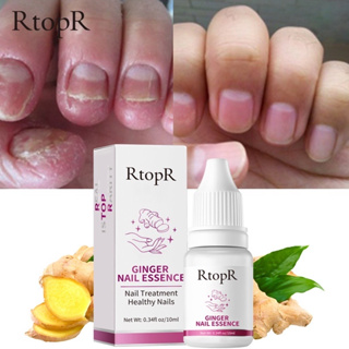 ของแท้100% RtopR FDA ยาทาเล็บป้องกันเชื้อแบคทีเรีย รักษาโรคเชื้อราที่เล็บ เล็บพัง ดูแลเล็บ 10 มล.