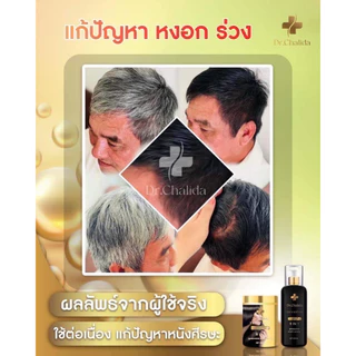 [1แถม1+ลด50%ในไลฟ์✅]Dr.Chalida ดร.ชลิดา แชมพูสมุนไพร ลดผมร่วง ลดหงอก ลดรังแค ไม่ผสมสารเคมี