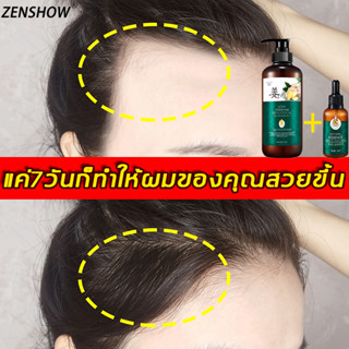 【มีสต๊อกในไทย】ZENSHOW แชมพูขิง 500ml ยาสระผมเร่งยาว แชมพูแก้ผมร่วง ขิงช่วยป้องกันผมร่วง สูตรน้ำขิง ปลูกผมอย่างอ่อนโยน