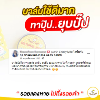 Chicky Mild บาล์มทายุงกัด ครีมทายุงกัด บาล์มลดคัน ช่วยลดคัน ลดบวมแดง ไม่ทิ้งรอยดำ ป้องกันขาลาย