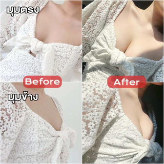 บราซิลิโคนดันทรง อกชิดฟู เนื้อแมทไร้ขอบหนา 0.2 mm. ซิลิโคนเกาะอก Freesize กาว Medical Grade ติดทน กันน้ำ | missBBgirl