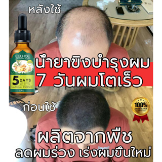 EELHOE 30ml น้ำยาปลูกผมดก เซรั่มปลูกผม น้ำยาปลูกผม ฟื้นฟูผม ป้องกันผมร่วง เซรั่มบำรุงผม เร่งผมขึ้นใหม่ รักษาผม ลดผมร่วง