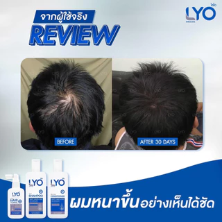 LYO Hair Tonic 30 ml. ไลโอ แฮร์โทนิค เซรั่มผม หนุ่มกรรชัย แชมพูสระผม ยาสระผม แชมพู ของแท้ Official