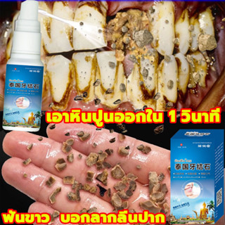 ⚡️เอาหินปูนออกใน 1 วินาที น้ำยากำจัดหินปูน 30ML ขจัดคราบหินปูน น้ำยากำจัดหินปูน ยาสีฟันฟอกฟันขาว Dental stone spray