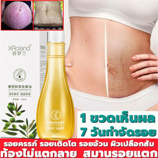 XRoland ครีมลดรอยแตก 150g ขาแตกลาย ลดรอยแตกลาย ครีมทาท้องลาย ครีมลดรอยแตกลาย แก้ท้องลาย กระชับผิวให้เรียบเนียน