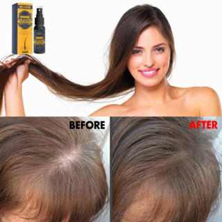 Hair growth castor oil spray สเปรย์ดูแลหนังศรีษะลดการหลุดล่วงของเส้นผม