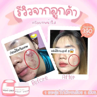 ครีมเทพหน้าใส ลดสิวหน้าใส 17g