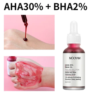 L272 มาส์กแดง หน้าใส AHA MOOYAM AHA 30% + BHA 2% เซรั่มไวท์เทนนิ่ง ผลิตภัณฑ์ดูแลผิวหน้า กําจัดสิว ควบคุมความมัน 30 มล.