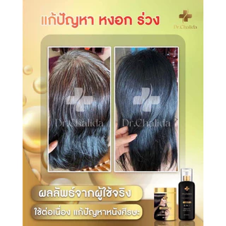 [1แถม1+ลด50%ในไลฟ์✅]Dr.Chalida ดร.ชลิดา แชมพูสมุนไพร ลดผมร่วง ลดหงอก ลดรังแค ไม่ผสมสารเคมี