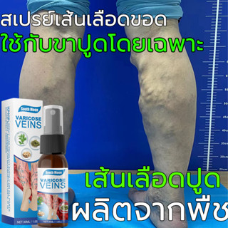 Varicoseveinsสเปรย์ฉีดเส้นเลือดขอด30ml  ส่งเสริมการไหลเวียนเลือด  ยาทาเส้นเลือดขอด ครีมทาเส้นเลือดขอด