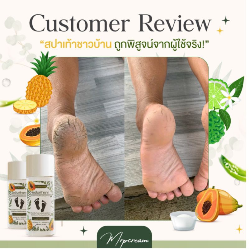 สปาเท้าชาวบ้าน MRPCREAM สปาส้นเท้าแตก