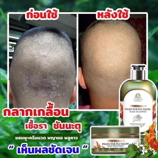 แชมพูพญายอพลูคาว กำจัดรังแค เเก้หนังหัวแห้ง ลอก เชื้อรา บนหนังศีรษะ ผมร่วง ของเเท้100%