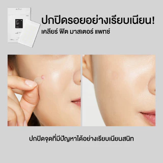 COSRX Clear Fit Master Patch แผ่นแปะสิวรุ่นบางพิเศษ ปลอดภัย แต่งหน้าทับได้