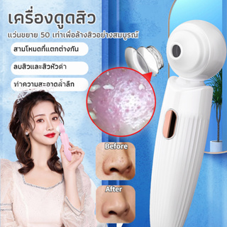 เครื่องดูดสิว สิวข้างจมูก ดูดสิวเสี้ยนอุดตันลบรอยจุดดำจากสิวเสี้ยนที่จมูก พร้อมส่ง