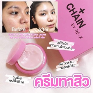 ครีมCHAIN By Re-X ครีมรักษาสิว ลดสิว ผิวหน้าเนียนกระจ่างใสขึ้น 5 กรัม