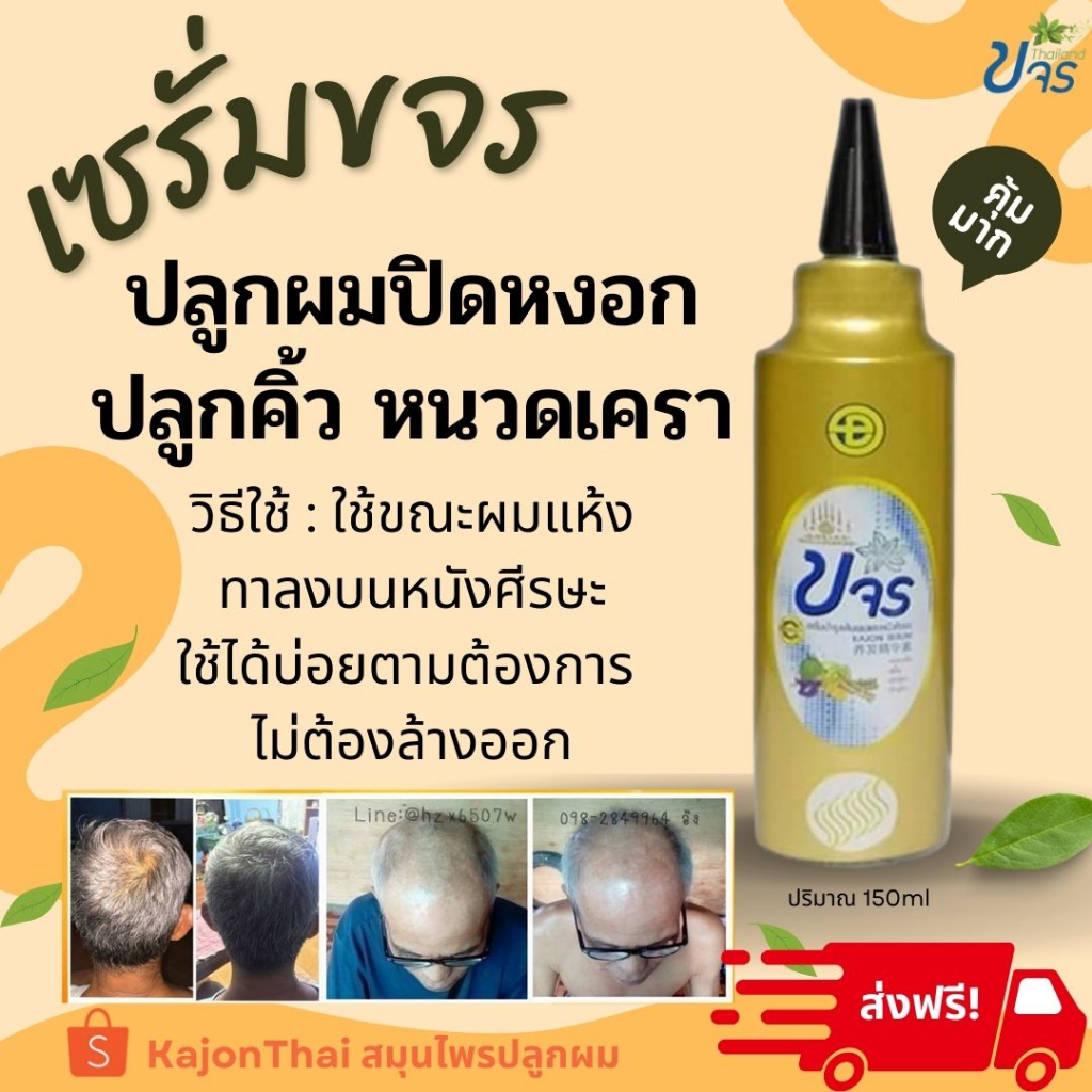 เซรั่มขจร ปลูกผมของแท้จากโรงงาน โฉมใหม่ ล็อตใหม่ล่าสุด!!สมุนไพรขจรสูตรเข้มข้นกระตุ้นการงอกของผมใหม่รากผมแข็งแรงลดผมร่วง