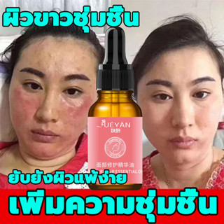 FUEYAN เซรั่มบํารุงผิวหน้า 10ml บํารุงผิวหน้า ลดริ้วรอย กระชับรูขุมขนเผยผิวกระจ่างใสบอกลาปัญหาสิวเซรั่มบํารุงผิว