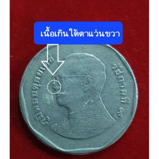 เหรียญ 5 บาทพ.ศ.2559มีจุดใต้แว่นด้านขวา