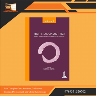 Hair Transplant 360: Advances, Techniques, Business Development, and Global Perspectives
