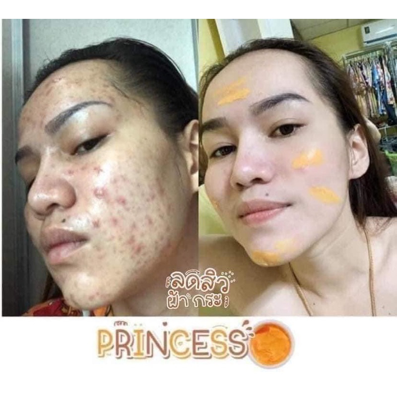 ครีมขมิ้นprincess Princess night cream 5 กระปุก