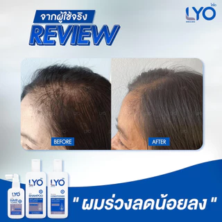 LYO Hair Tonic 30 ml. ไลโอ แฮร์โทนิค เซรั่มผม หนุ่มกรรชัย แชมพูสระผม ยาสระผม แชมพู ของแท้ Official