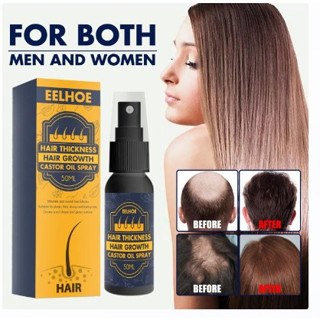 Hair growth castor oil spray สเปรย์ดูแลหนังศรีษะลดการหลุดล่วงของเส้นผม