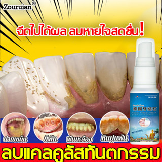 ⚡️เอาหินปูนออกใน1วินาที⚡️Zouruian ขจัดคราบหินปูน กำจัดกลิ่นปาก ฟอกฟันขาว น้ำยากำจัดหินปูน กำจัดหินปูนฟัน กําจัดนิ่วในฟัน