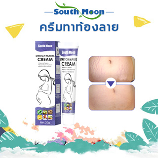 【จัดส่งจากกรุงเทพฯ】South Moon ครีมลดรอยแตก ครีมทาท้องลาย 20g ใช้ได้ทั้งรอยแตกลายใหม่และเก่า