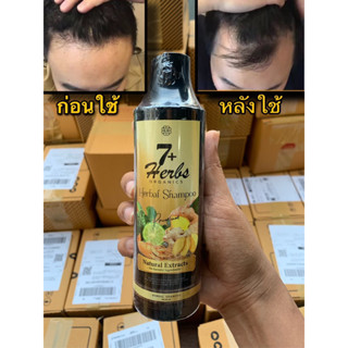 แชมพูปลูกผม7Herbs ลดร่วงแก้หัวล้าน ลดอาการคันหนังศรีษะบำรุงรากผม