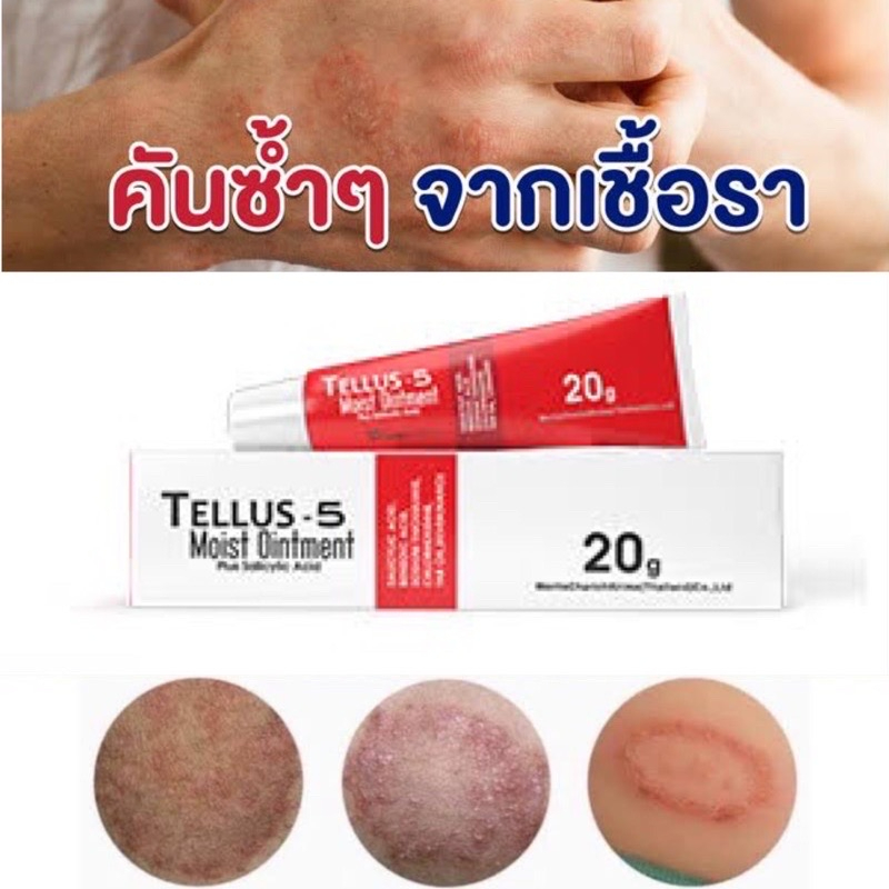 สะเก็ดเงิน Tellus Ointment Tellus-5 ทาเชื้อรา ทารักษา เชื้อรา คัน จากเชื้อรา  #20 กรัม