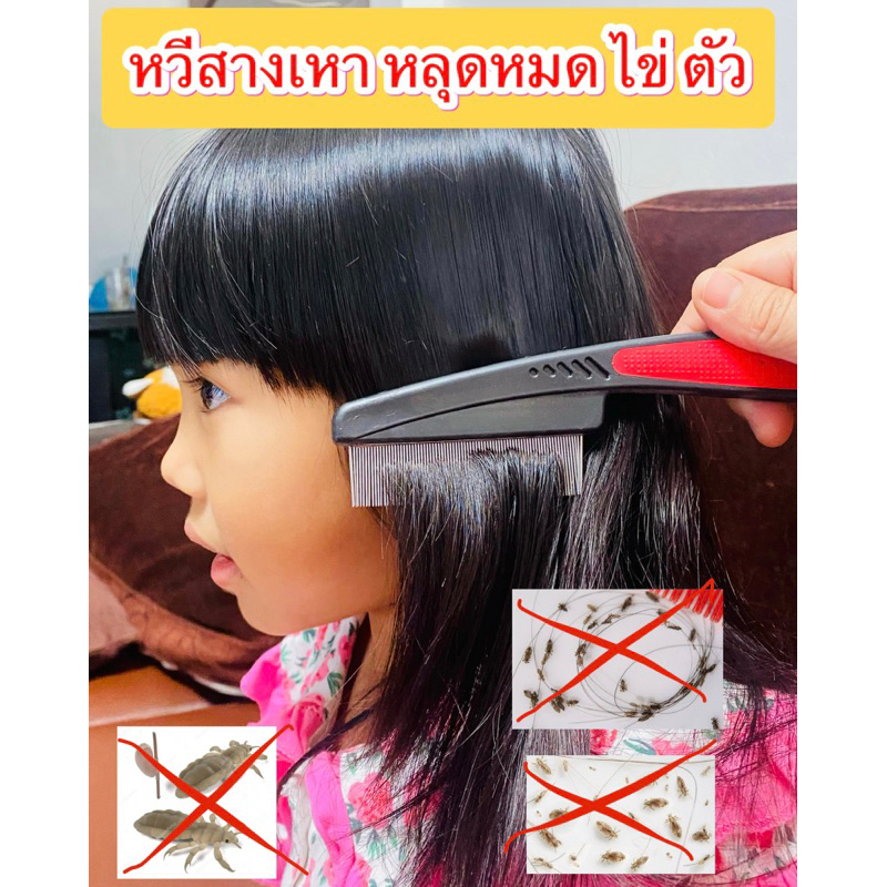 🇹🇭 ร้านไทย 🇹🇭 หวีสางเหา หวีสางไข่เหา หวีเสนียด