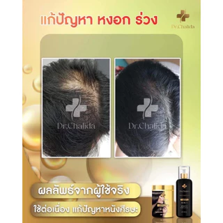 [1แถม1+ลด50%ในไลฟ์✅]Dr.Chalida ดร.ชลิดา แชมพูสมุนไพร ลดผมร่วง ลดหงอก ลดรังแค ไม่ผสมสารเคมี