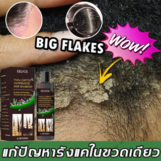 【มีสต๊อกในไทย】EELHOE แชมพูขจัดรังแค 100ML ขจัดรังแค หยุดอาการคัน ควบคุมน้ำมัน แชมพูสมุนไพร บำรุงเส้นผมและหนังศรีษะ