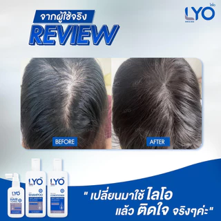 LYO Hair Tonic 30 ml. ไลโอ แฮร์โทนิค เซรั่มผม หนุ่มกรรชัย แชมพูสระผม ยาสระผม แชมพู ของแท้ Official