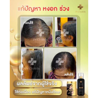[1แถม1+ลด50%ในไลฟ์✅]Dr.Chalida ดร.ชลิดา แชมพูสมุนไพร ลดผมร่วง ลดหงอก ลดรังแค ไม่ผสมสารเคมี