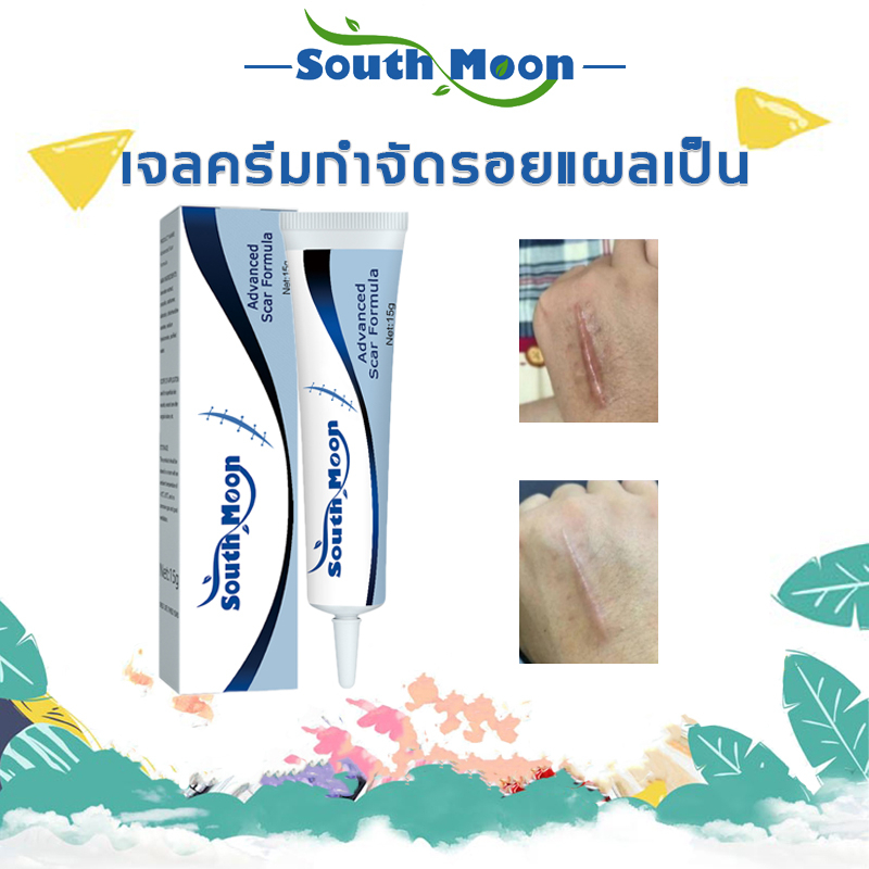 【จัดส่งจากกรุงเทพฯ】South moonเจลลบรอยแผลเป็นจากสิว เจลลดรอยแผลจากสิว สการ์เจล รอยแตกลาย  สการ์เจล15g