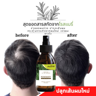 แก้ผมร่วงผู้ชาย สเปรย์โรสแมรี่ ปลูกผม hair serum hair fall แก้ผมร่วง เร่งผมยาว โควิดผมร่วง hair tonic