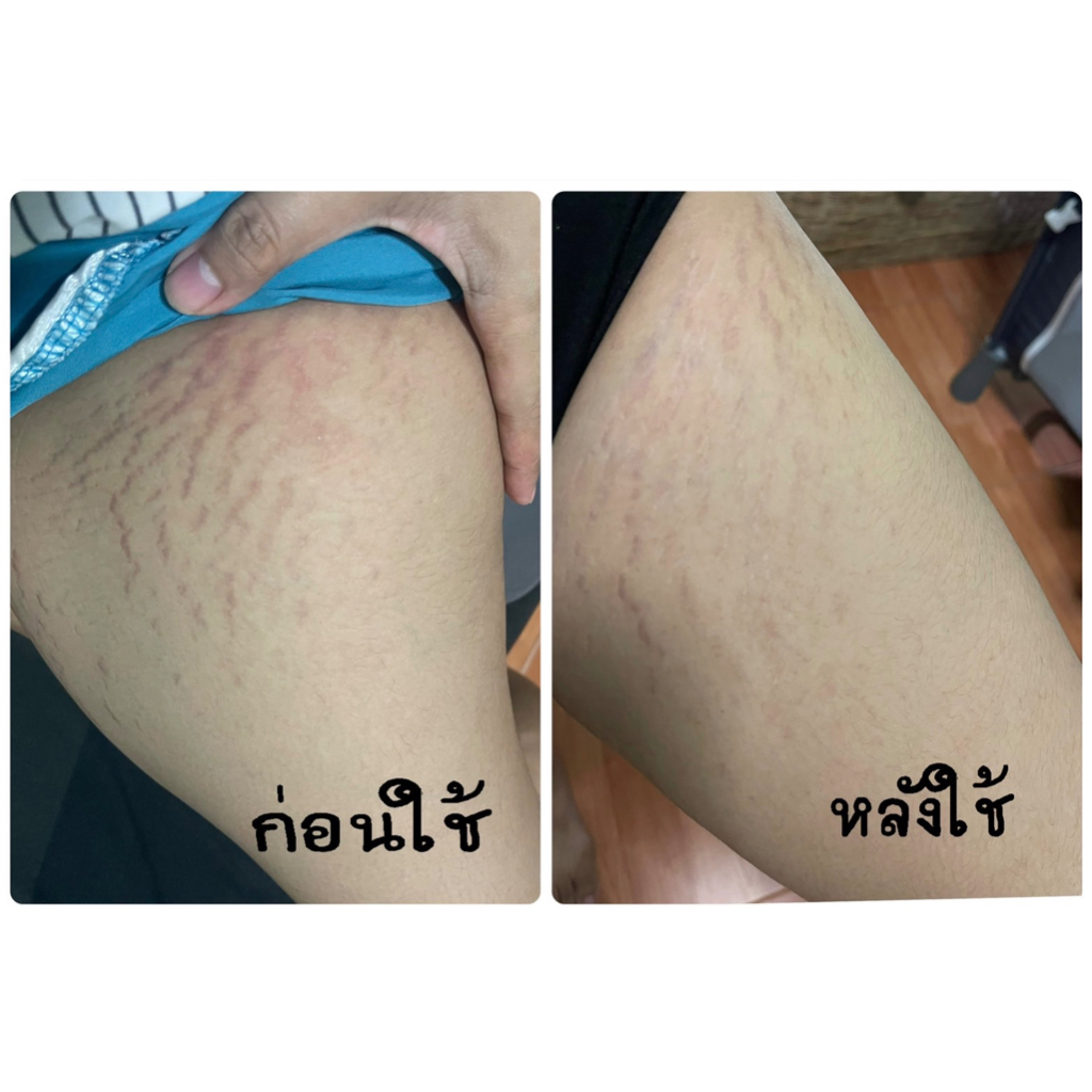 ครีมPWB 500 Ml. มีหัวปั๊มทุกออเดอร์ (ร้านบริษัทหลัก) รูปที่ 2
