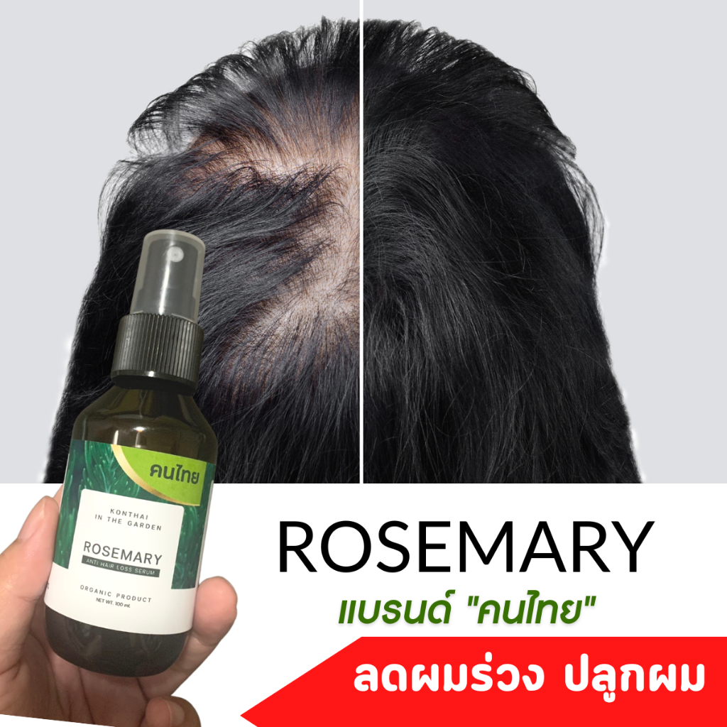สำหรับผมร่วงหนัก สเปรย์โรสแมรี่ ผมร่วงโควิด ผมร่วงคีโม ปลูกผม รากผม เซรั่มผมบาง เซรั่มปลูกผม