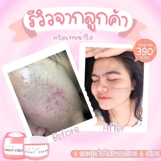 ครีมเทพหน้าใส ลดสิวหน้าใส 17g