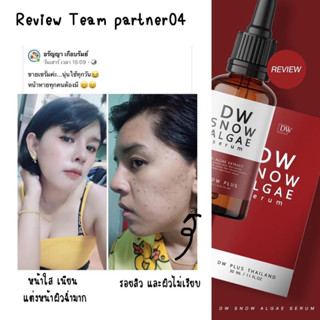 เซรั่มสาหร่ายหิมะแดง snow algae serum