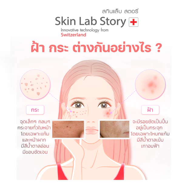 SKINLAB สกินแล็บ สบู่วิตมิน C เยอะมากๆ สะอาดผิว SC 70 กระจ่างใส รอยสิวฝ้า จางลง อ่อนโยนต่อผิว แม้ผิวแพ้ง่าย thumbnail 4