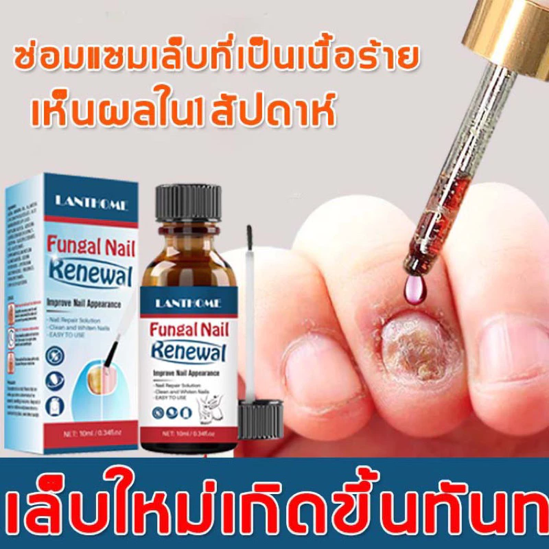 *ส่งจากไทย* บำรุงเล็บ กำจัดเชื้อราเล็บ ทาเชื้อราเล็บ ฆ่าเชื้อราเล็บ กันเชื้อราเล็บ เชื้อราเล็บ เซรั่มบำรุงเล็บ