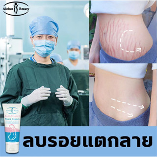 AICHUNครีมกันแตกลาย ครีมลดรอยแตกลาย ครีมทาท้อง ครีมทาท้องลาย60กรัม แก้แตกลาย ครีมแก้ท้องแตกลาย ครีมแก้ท้องลาย ลดผิวแตกลา