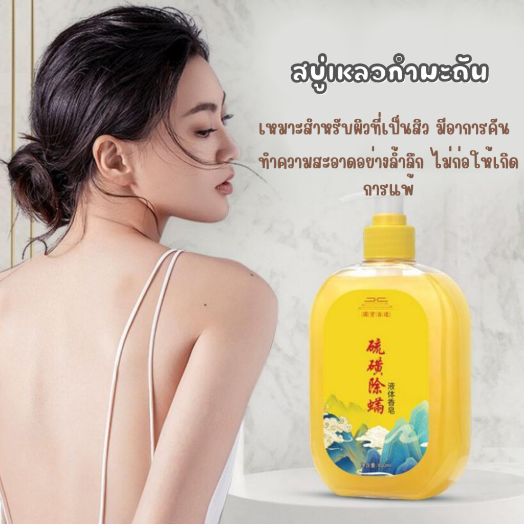 ใหม่/ของแท้ สบู่เหลวกำมะถันสูตรอ่อนโยนเหมาะสำหรับผิวที่เป็นสิวมีอาการคัน ล้างสิ่งสกปรก ฆ่าเชื้อแบคทีเรีย ให้ความชุ่มชื่น