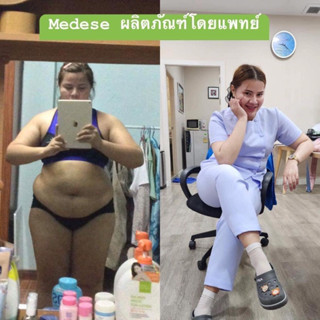 Medilene เมดิลีน ลดน้ำหนัก คุมหิวโดยแพทย์ ของแท้💯มีเก็บเงินปลายทาง