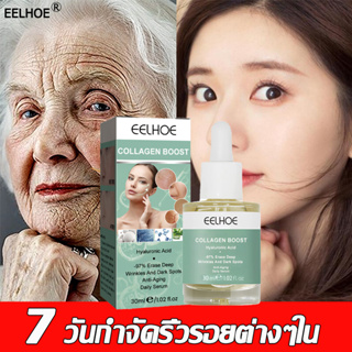 🔥7 วันกําจัดริ้วรอยต่างๆใน 🔥ครีมลดเลือนริ้วรอย 30ml ครีมยกกระชับ ครีมต่อต้านริ้วรอย ครีมลบเลือนริ้วรอย ครีมริ้วรอย